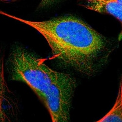 GALK1 Antibody, Novus Biologicals 0.1mL; Unlabeled:Antibodies, Polyclonal